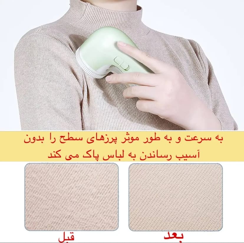پرزگیر لباس